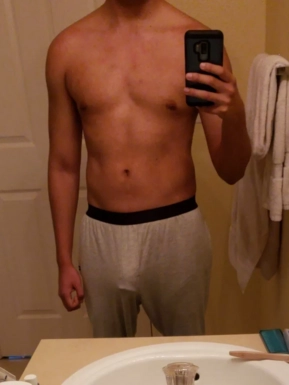 @arci1029